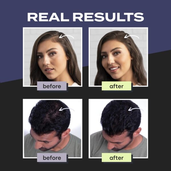 Toppik Hair Building Fibers,Thinning Hair Instantly Thicker, Dark brown - Image 2